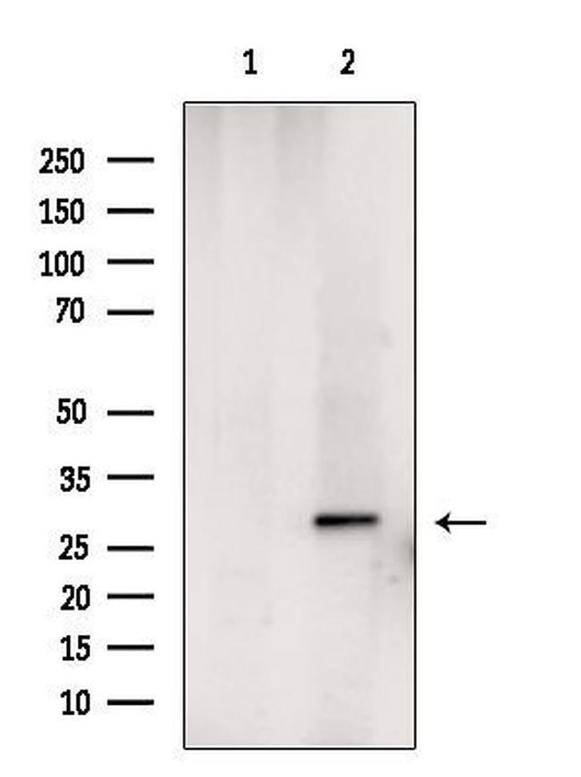 CENPH Antibody in Western Blot (WB)