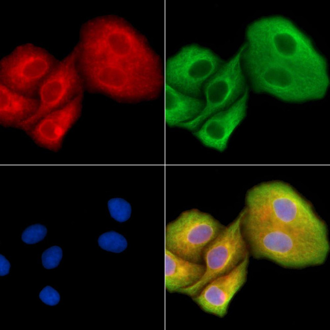 HUS1B Antibody in Immunocytochemistry (ICC/IF)