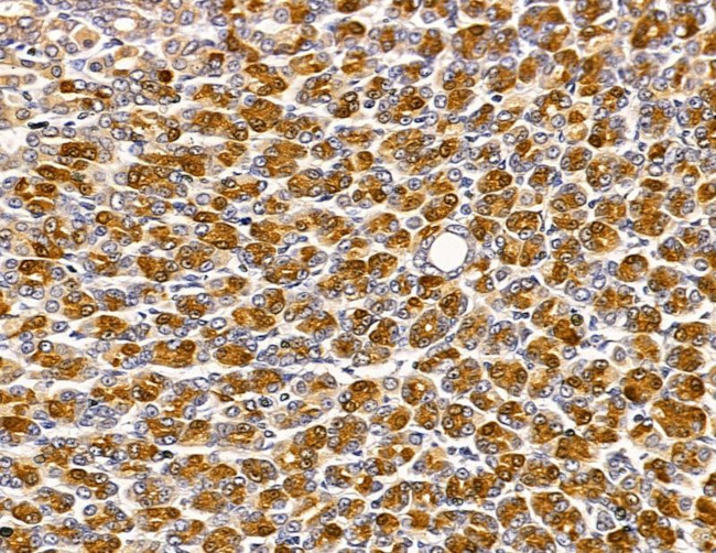 HUS1B Antibody in Immunohistochemistry (Paraffin) (IHC (P))