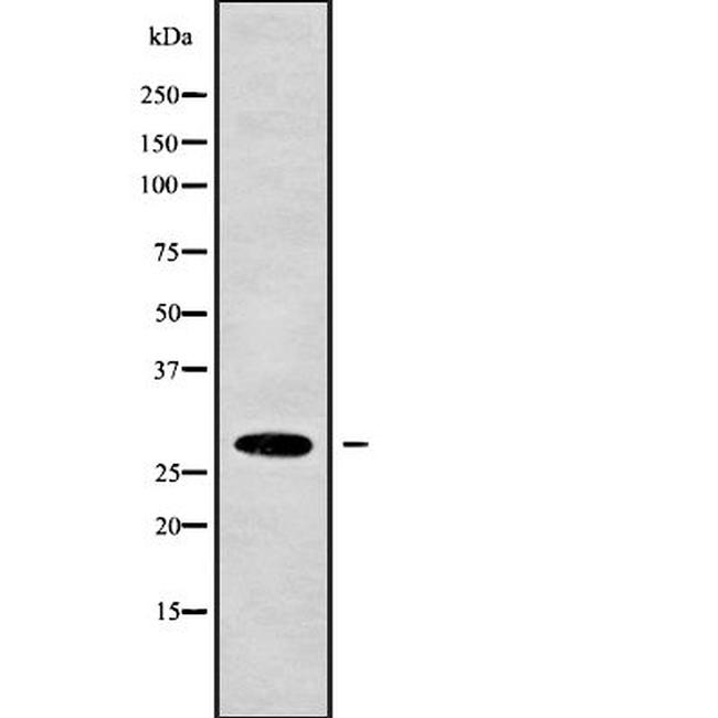 HUS1B Antibody in Western Blot (WB)