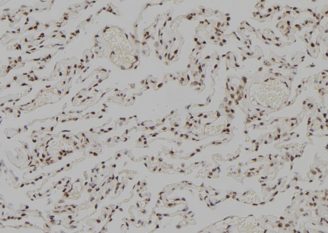 RFC5 Antibody in Immunohistochemistry (Paraffin) (IHC (P))