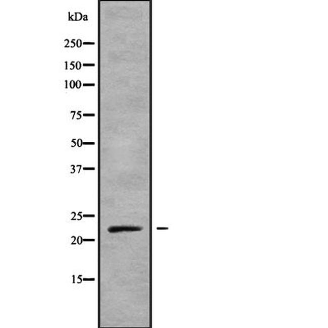 KappaB ras1 Antibody in Western Blot (WB)