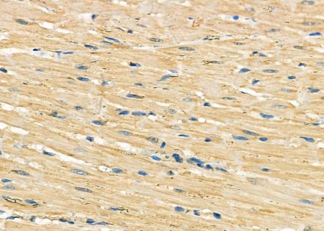 GOLT1B Antibody in Immunohistochemistry (Paraffin) (IHC (P))