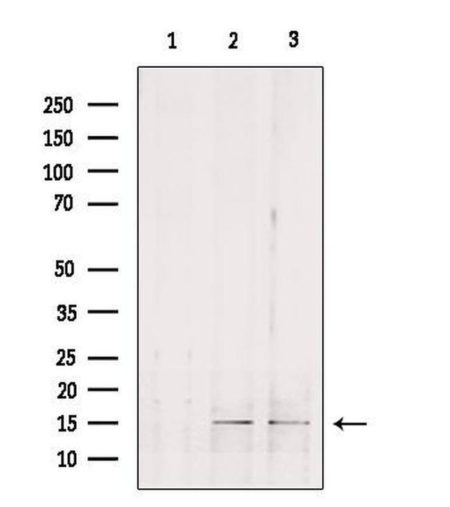 GOLT1B Antibody in Western Blot (WB)