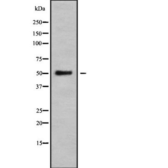 BCL6B Antibody in Western Blot (WB)