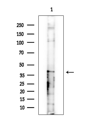 PSMD13 Antibody in Western Blot (WB)