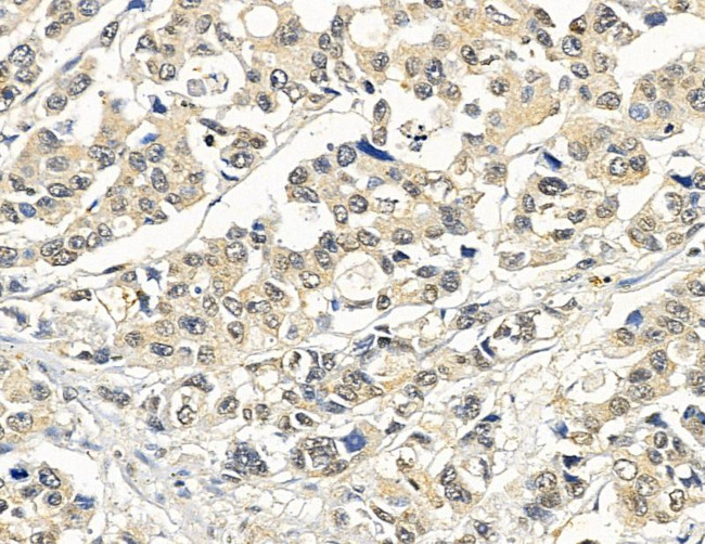 PSMD9 Antibody in Immunohistochemistry (Paraffin) (IHC (P))