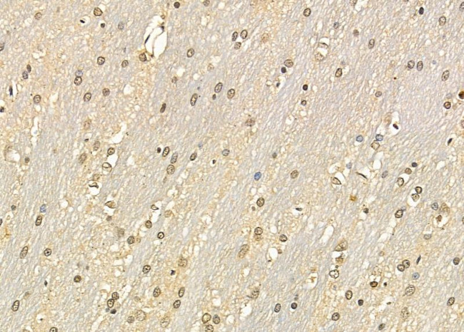 PSMD9 Antibody in Immunohistochemistry (Paraffin) (IHC (P))