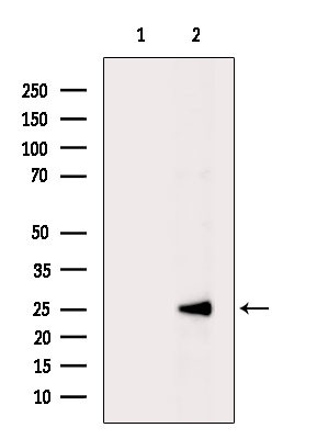 PSMD9 Antibody in Western Blot (WB)