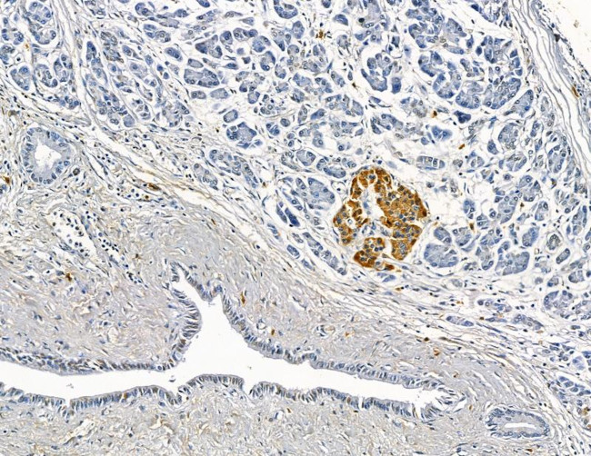 MOGAT3 Antibody in Immunohistochemistry (Paraffin) (IHC (P))