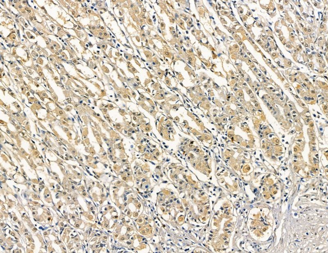 MOGAT3 Antibody in Immunohistochemistry (Paraffin) (IHC (P))