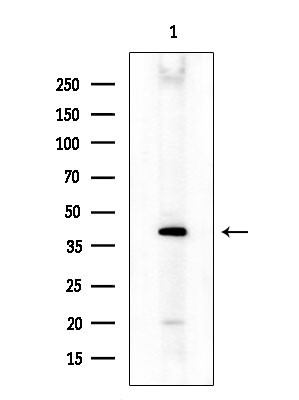 MOGAT3 Antibody in Western Blot (WB)