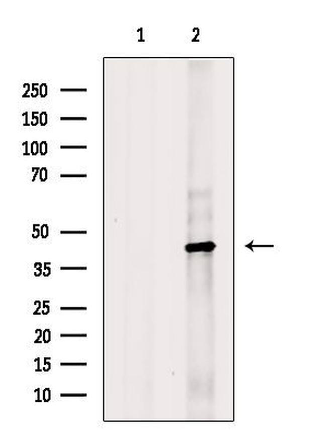 HSD3B1 Antibody in Western Blot (WB)
