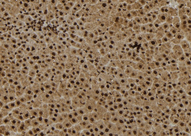 MPS1 Antibody in Immunohistochemistry (Paraffin) (IHC (P))