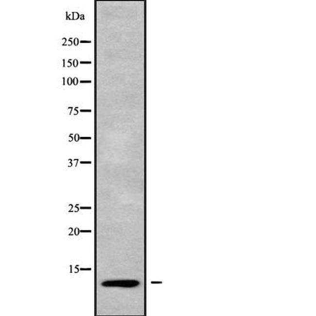 MPS1 Antibody in Western Blot (WB)