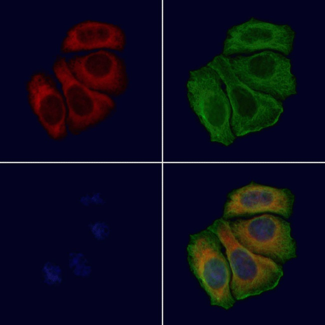 RPL24 Antibody in Immunocytochemistry (ICC/IF)