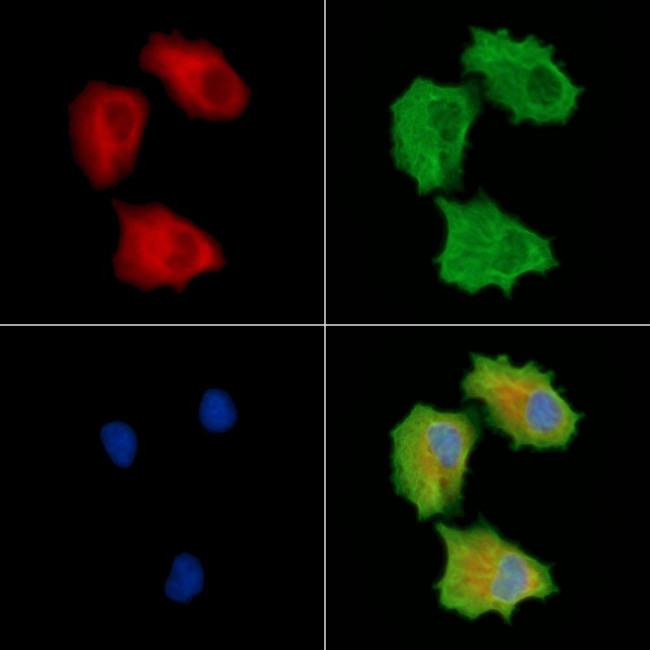 INPP5E Antibody in Immunocytochemistry (ICC/IF)