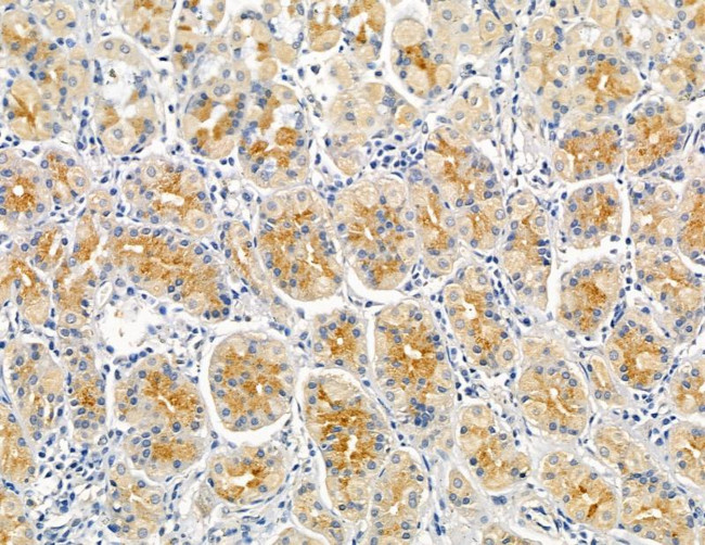 INPP5E Antibody in Immunohistochemistry (Paraffin) (IHC (P))