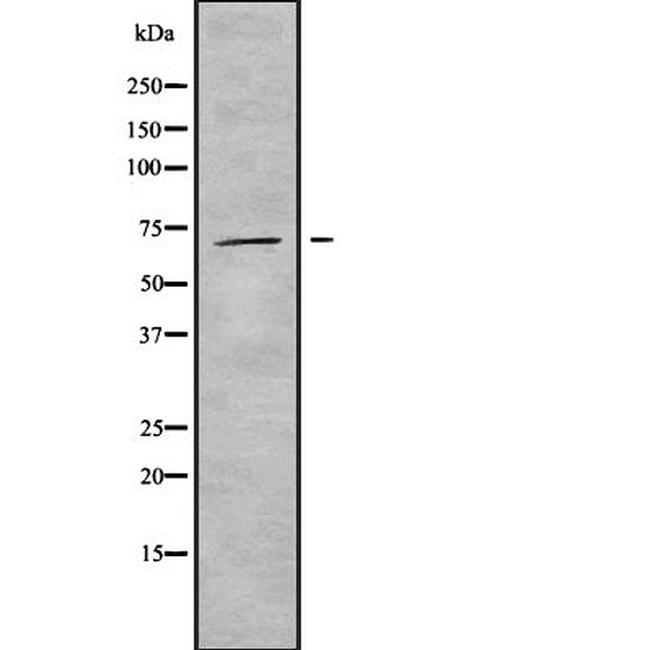 INPP5E Antibody in Western Blot (WB)