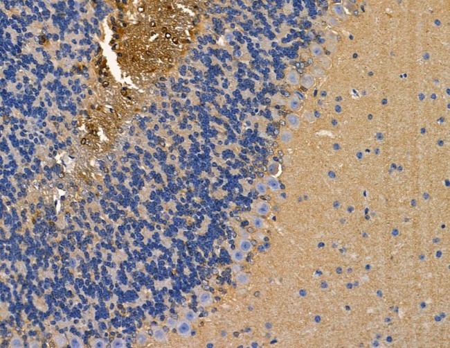 ABHD1 Antibody in Immunohistochemistry (Paraffin) (IHC (P))