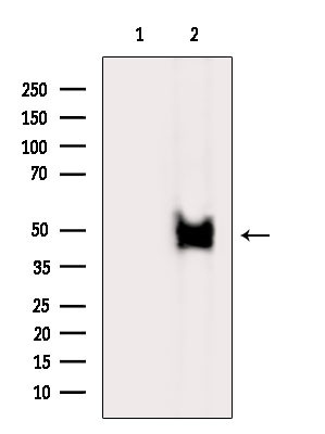 ABHD1 Antibody in Western Blot (WB)