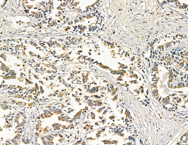 ABHD10 Antibody in Immunohistochemistry (Paraffin) (IHC (P))