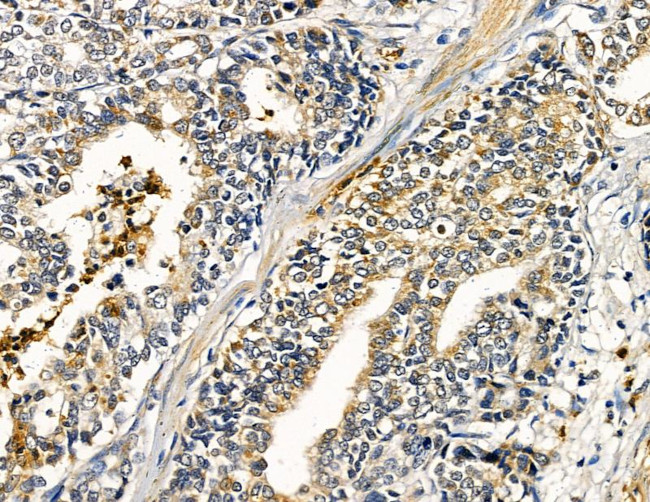 ABHD10 Antibody in Immunohistochemistry (Paraffin) (IHC (P))