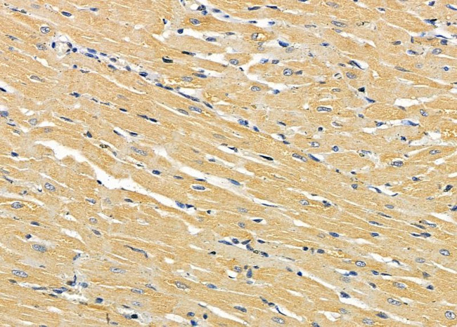 ABHD10 Antibody in Immunohistochemistry (Paraffin) (IHC (P))