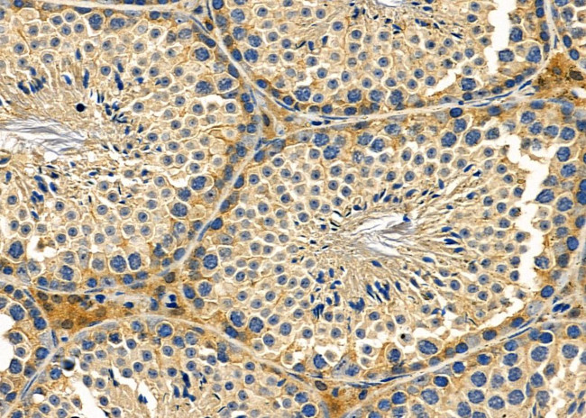 ABHD13 Antibody in Immunohistochemistry (Paraffin) (IHC (P))