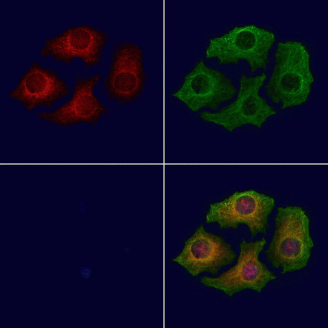 ABHD3 Antibody in Immunocytochemistry (ICC/IF)