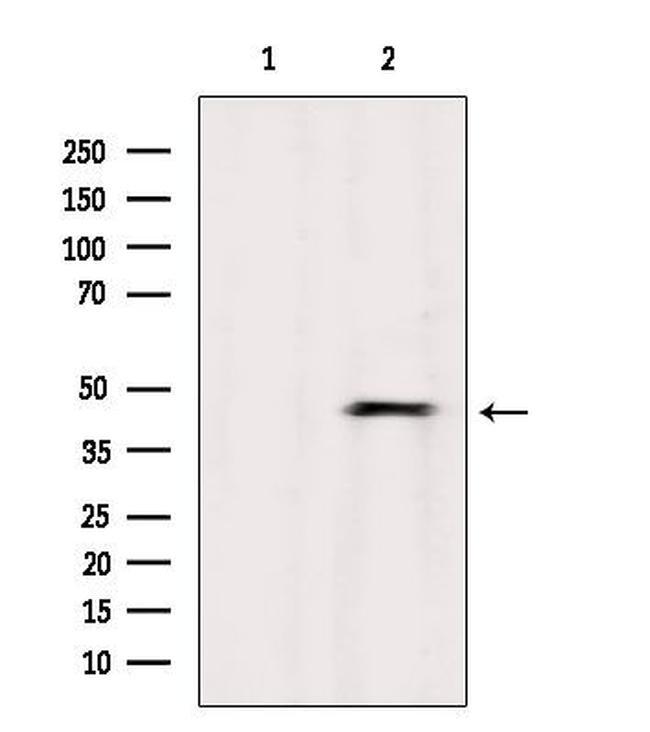 ABHD3 Antibody in Western Blot (WB)