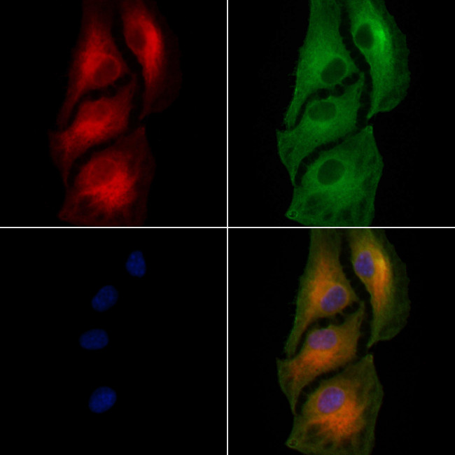 ABLIM1 Antibody in Immunocytochemistry (ICC/IF)