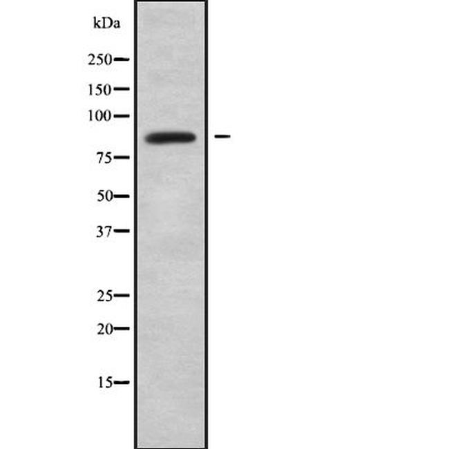 ABLIM1 Antibody in Western Blot (WB)