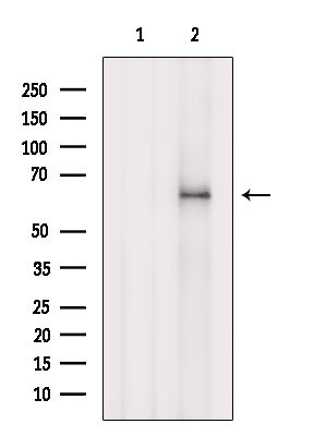 ACAD11 Antibody in Western Blot (WB)