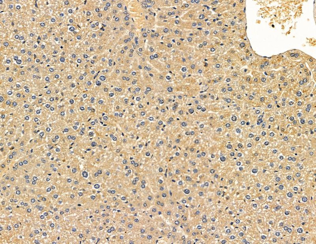 ACAD9 Antibody in Immunohistochemistry (Paraffin) (IHC (P))