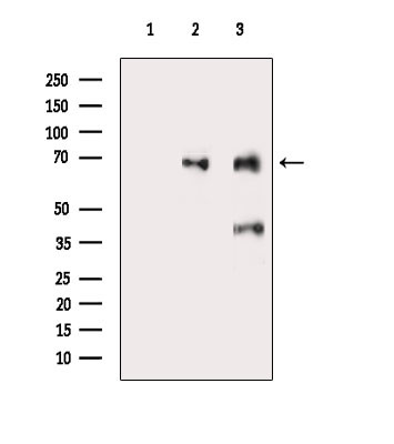 ACAD9 Antibody in Western Blot (WB)