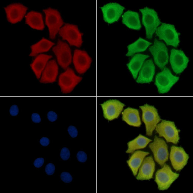 AWAT2 Antibody in Immunocytochemistry (ICC/IF)