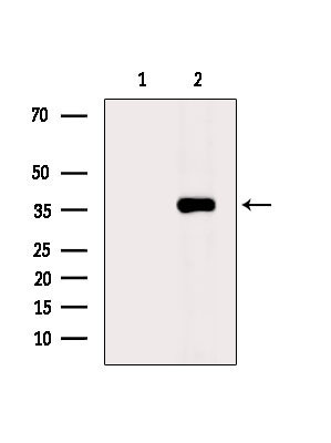 AWAT2 Antibody in Western Blot (WB)