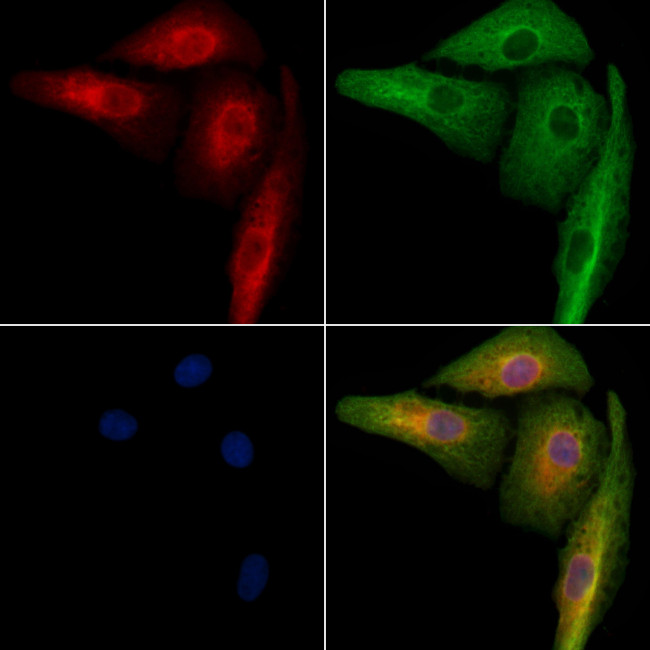 ACBD5 Antibody in Immunocytochemistry (ICC/IF)