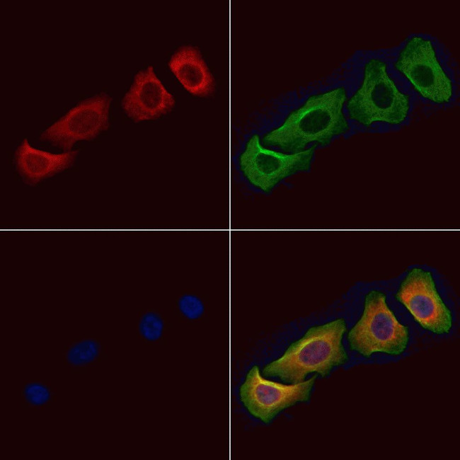 ACBD5 Antibody in Immunocytochemistry (ICC/IF)