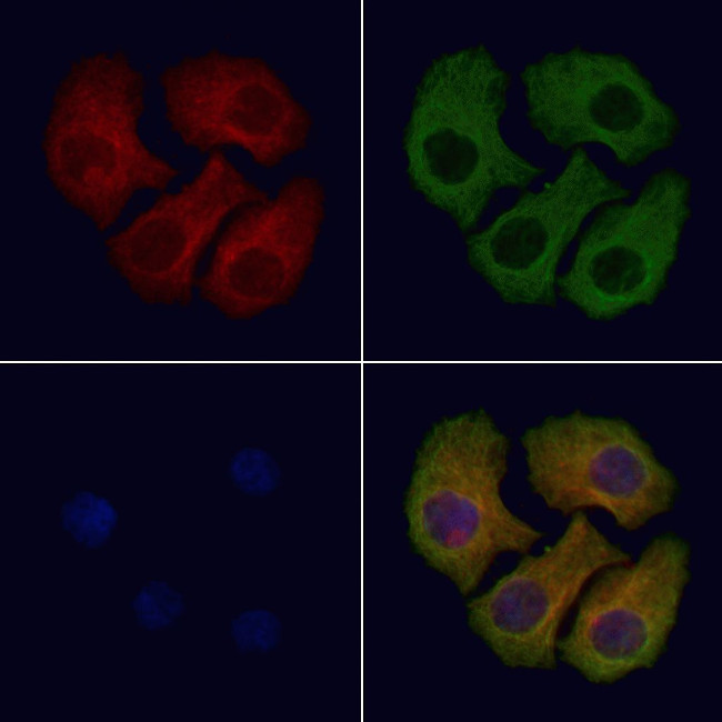 ACOX3 Antibody in Immunocytochemistry (ICC/IF)