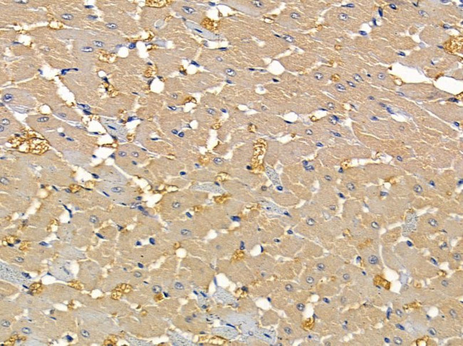 ACOT9 Antibody in Immunohistochemistry (Paraffin) (IHC (P))