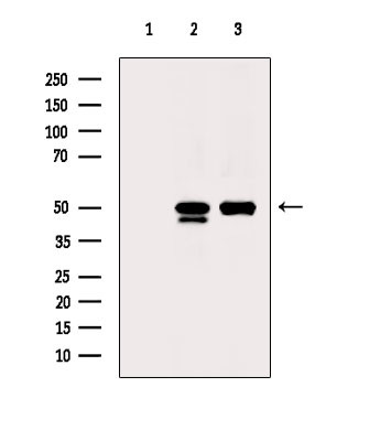 ACOT9 Antibody in Western Blot (WB)