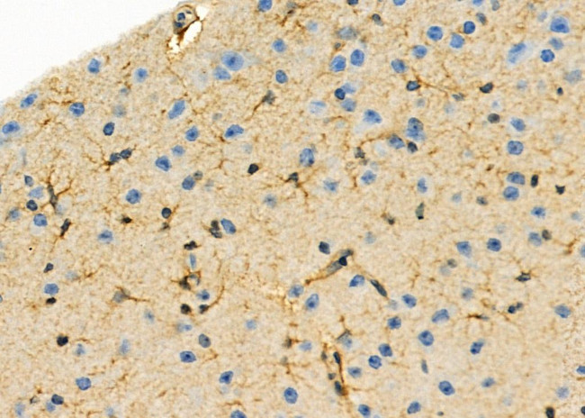 AOAH Antibody in Immunohistochemistry (Paraffin) (IHC (P))