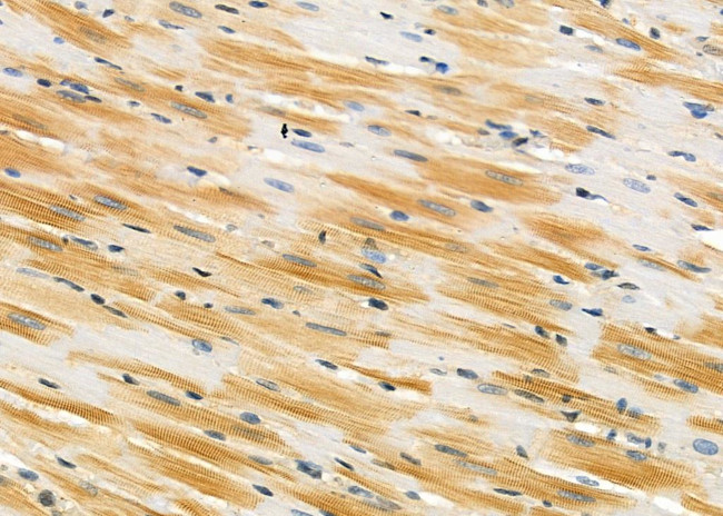 AOAH Antibody in Immunohistochemistry (Paraffin) (IHC (P))