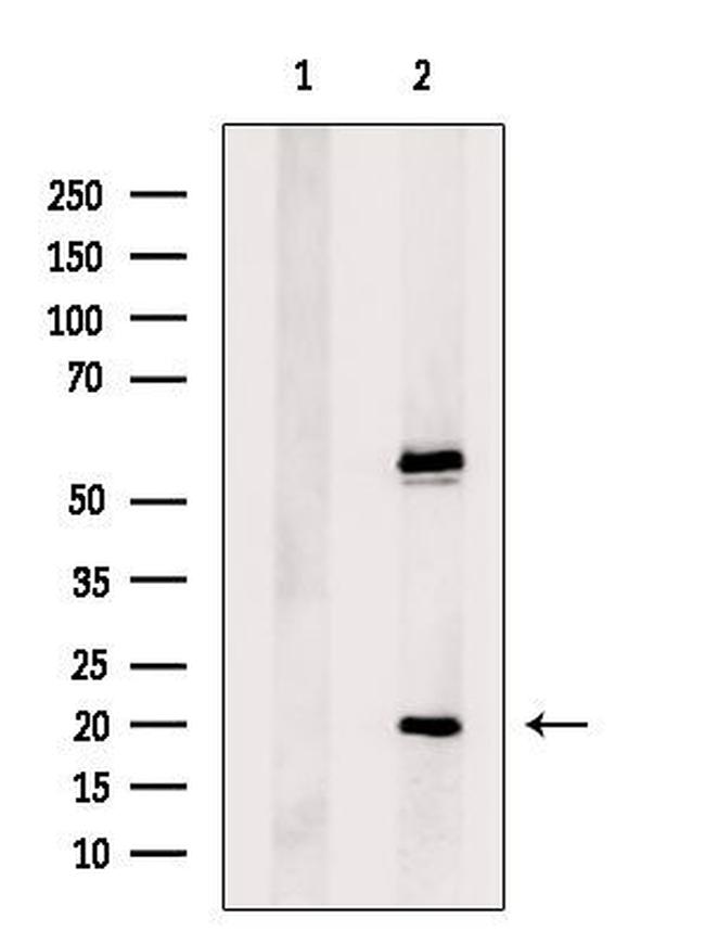 ACYP2 Antibody in Western Blot (WB)