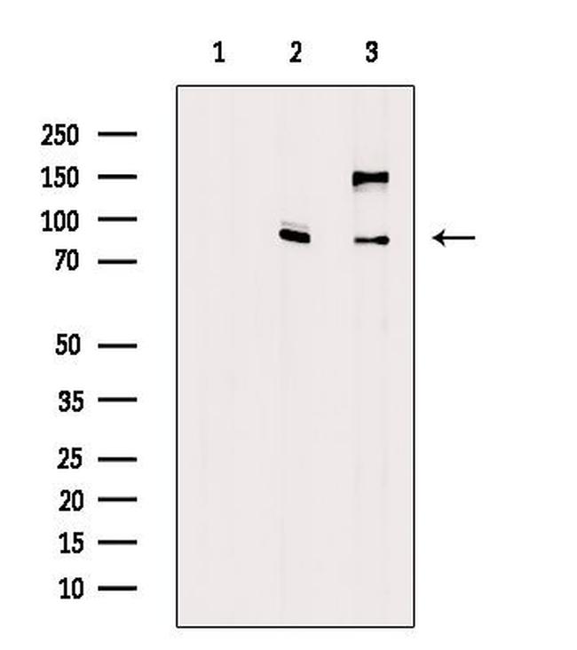 ADAM28 Antibody in Western Blot (WB)