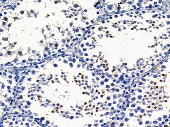 ADAM30 Antibody in Immunohistochemistry (Paraffin) (IHC (P))