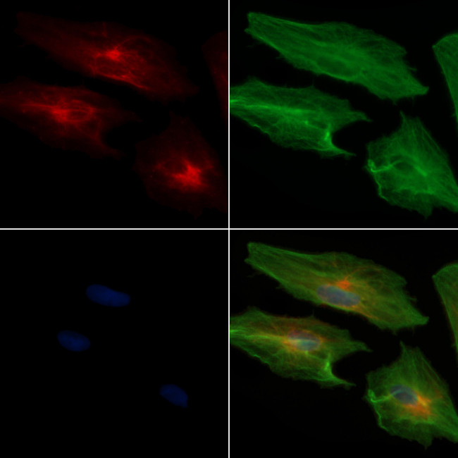 ADAM33 Antibody in Immunocytochemistry (ICC/IF)