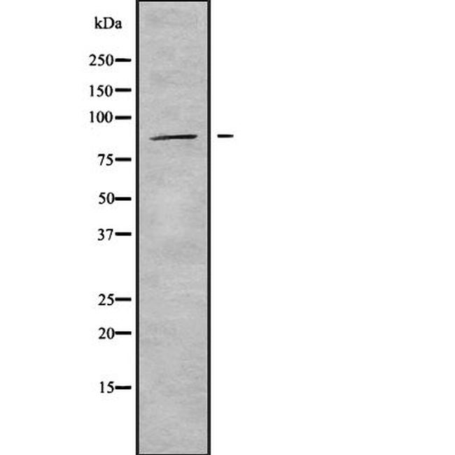ADAM33 Antibody in Western Blot (WB)